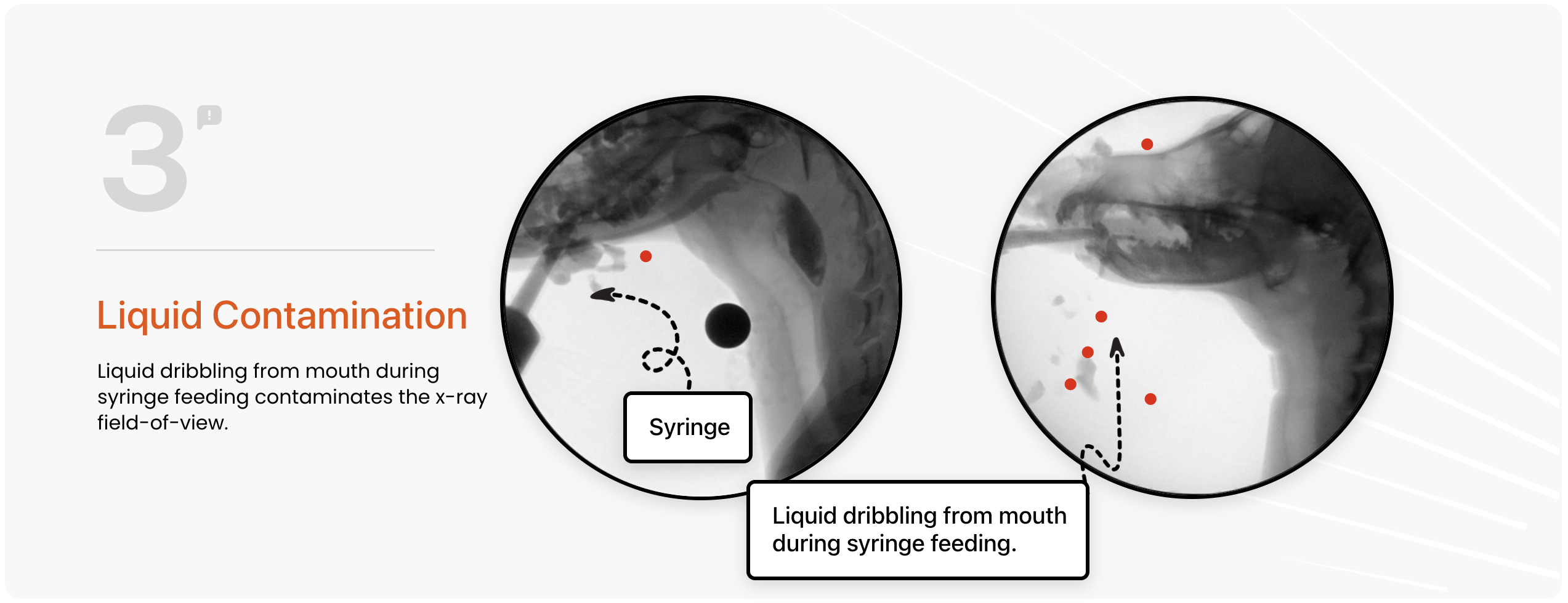 Liquid dribbling from the mouth during syringe feeding contaminates the x-ray field-of-view.